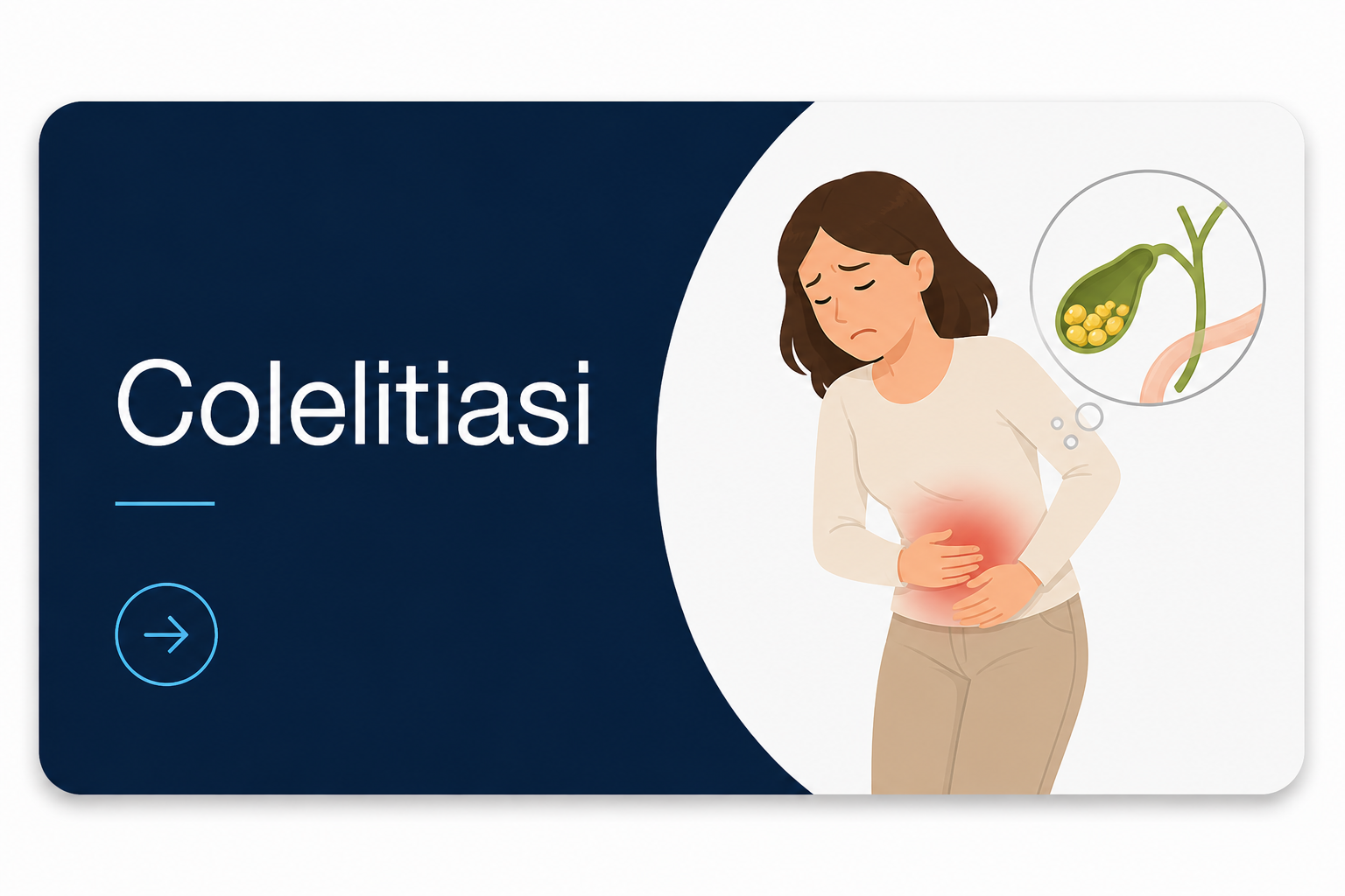 tasto colelitiasi